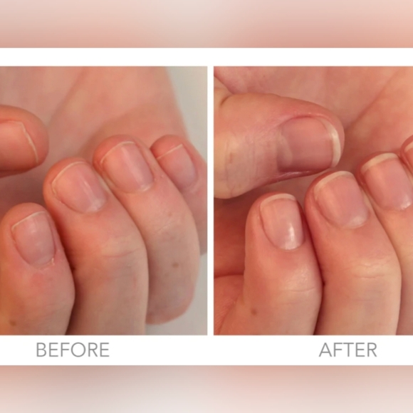 Restorative Nail Cream - Picture 4 of 8